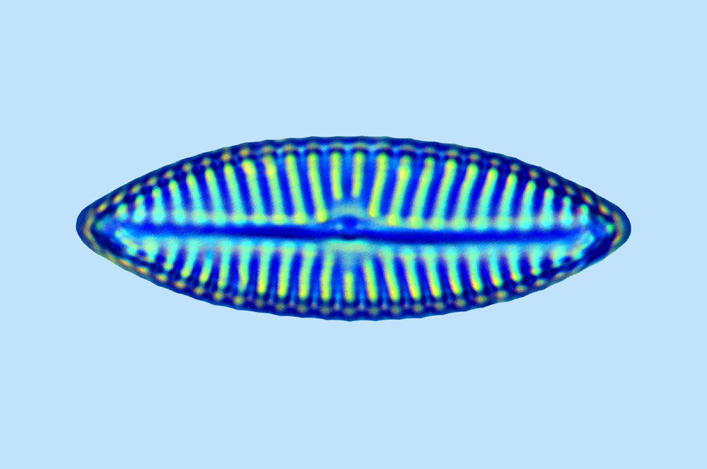 Amphora Navicula